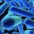 Een Listeria-besmetting: onoverkomelijk of beheersbaar?